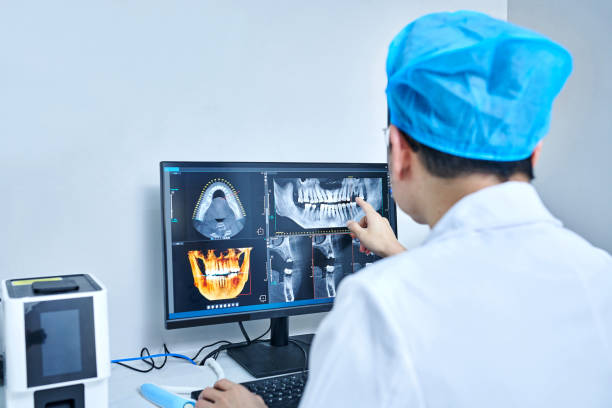 Best Emergency Wisdom Tooth Extraction in Bridge City, TX